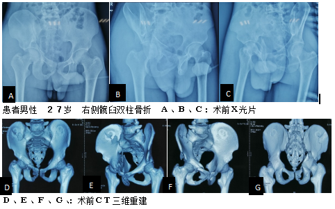微信图片_20240424152051.png 微信图片_20240424152051.png