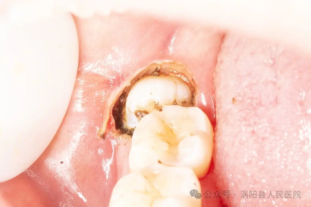 640_看图王.jpg 640_看图王.jpg