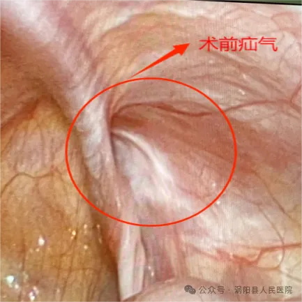 640 (1)_看图王.jpg