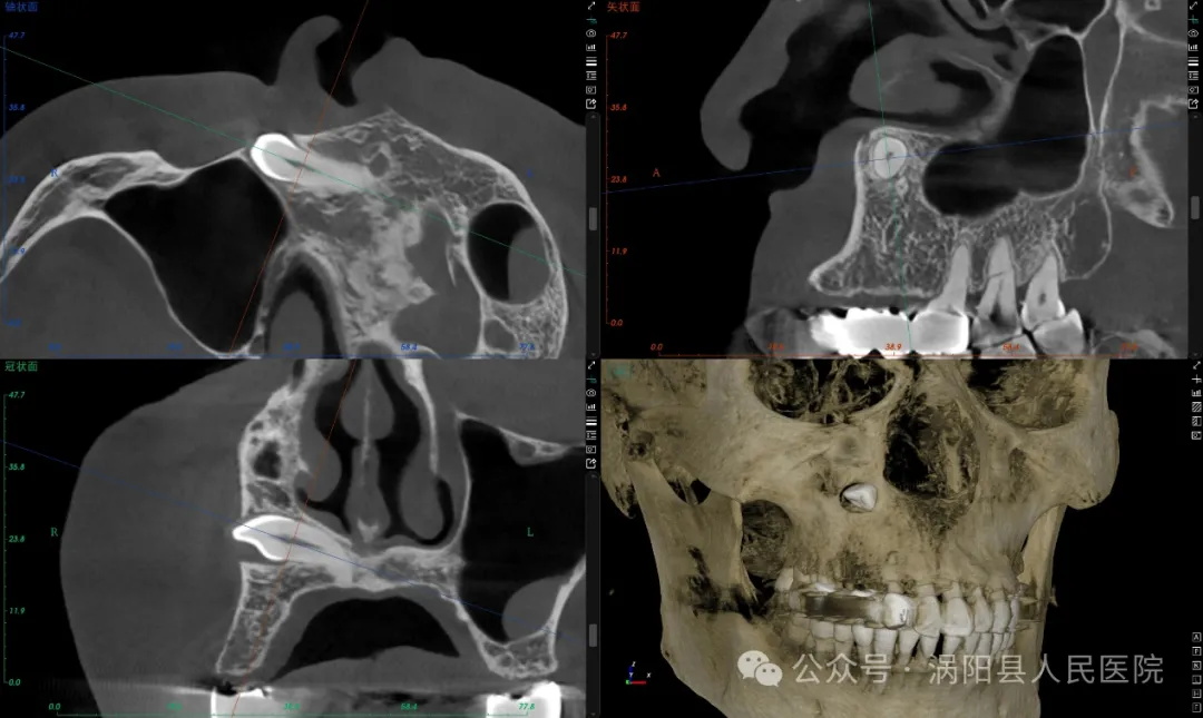 640 (1)_看图王002.jpg 640 (1)_看图王002.jpg