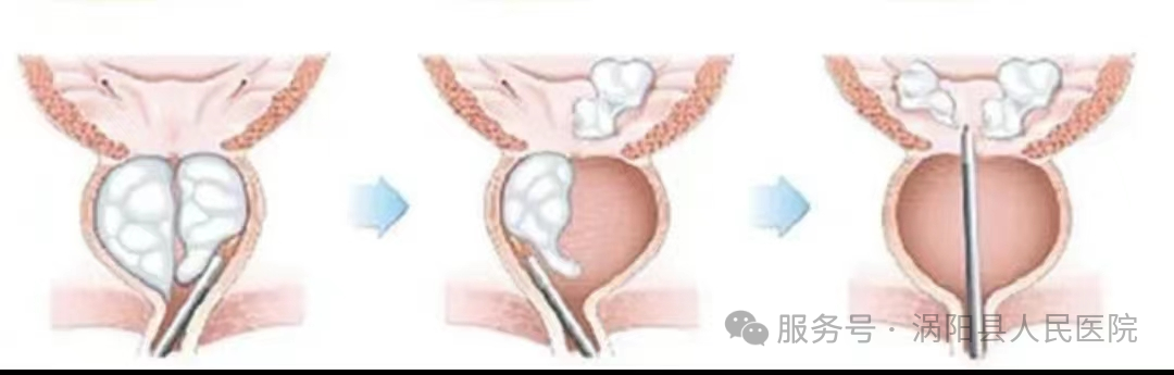 640 (14).png 640 (14).png