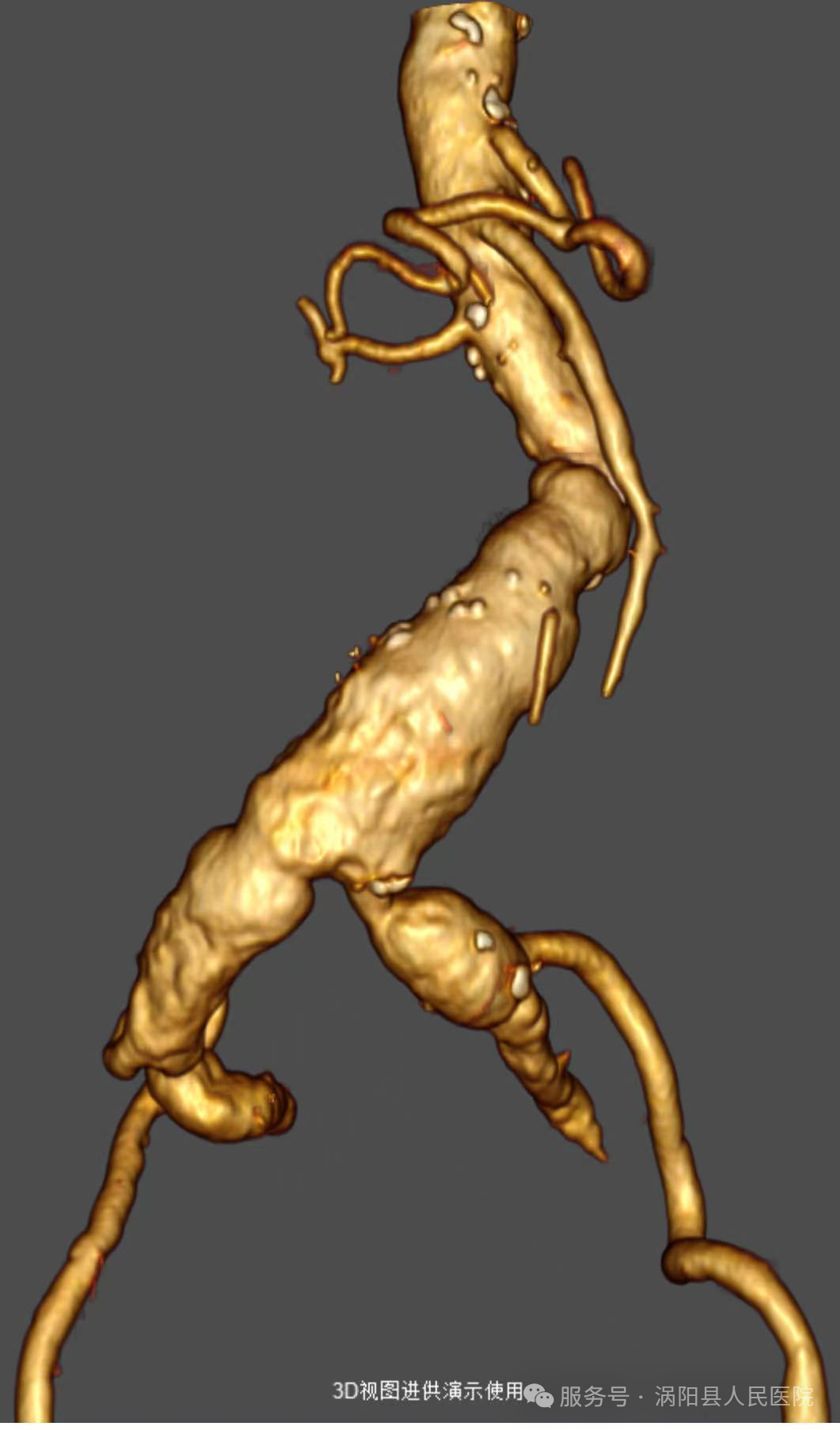 640 (4).png 640 (4).png